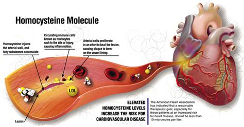 Why You Should Conduct Homocysteine Test for Cardiac Problems?