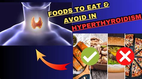 Hyperthyroidism Diet Plan | Hyperthyroidism Foods to Eat & Foods to ...