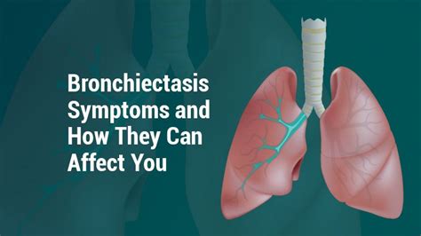 Pin on Bronchiectasis Battle