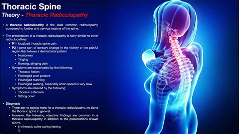 Thoracic RadiculopathIes | Introduction, Presentation, & Diagnosis ...