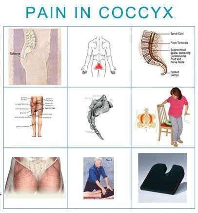 Expert Coccydynia Treatments From Our Friendly Physicians