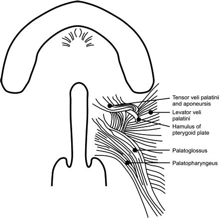 Primary Palatoplasty: Double-Opposing Z-Plasty (Furlow Technique) | Pocket Dentistry