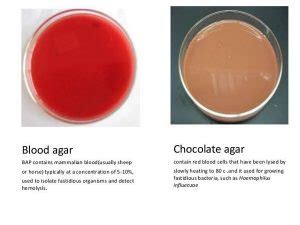 Chocolate Agar media - Preparation and Uses - Laboratoryinfo.com