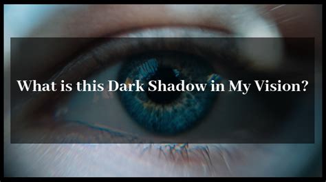 What is This Dark Shadow in My Vision? - VISIONAMERICA DOCTORS