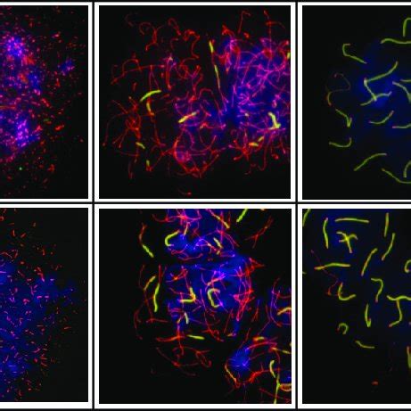 Absence of the diplotene stage in hsp90αgt/gt mutant germ cells of... | Download Scientific Diagram