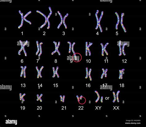 Karyotype male hi-res stock photography and images - Alamy