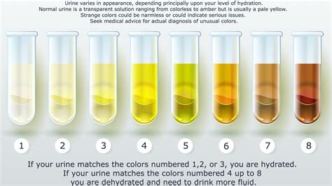 awasome pregnancy urine color chart article clubcolor vgw what color - 5 causes of dark urine ...