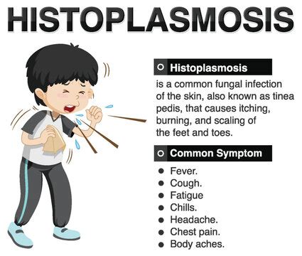 Histoplasmosis: Causes, Symptoms, Diagnosis Treatment, 42% OFF