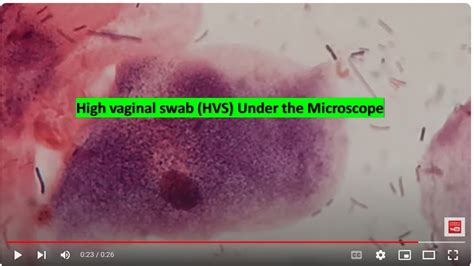 HVS under the microscope - YouTube