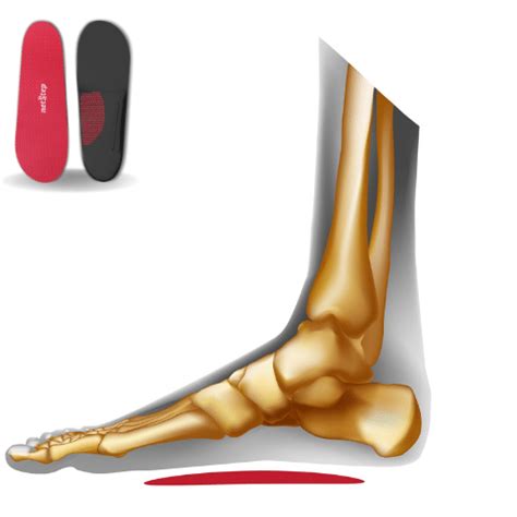 Orthotics For Flat Feet - Netstep