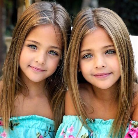 “The Most Beautiful Twins In The World”, See Where They Are Now | For Kids+