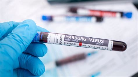 What is the Marburg virus? - Know about symptoms and transmission