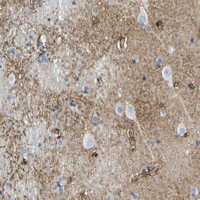 Otoferlin Antibody (NBP1-85233): Novus Biologicals