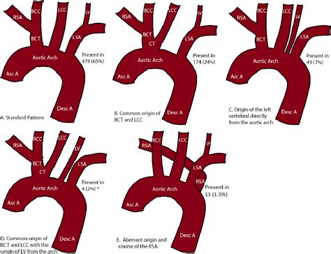 Figure 1 from Variations in the branching pattern of the aortic arch: an African perspective ...