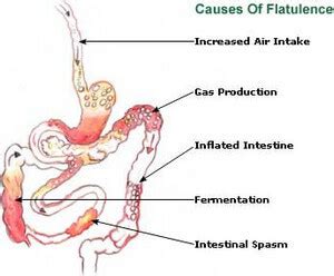 Excessive Bloating and Belching (Burping) - Causes, Management, Remedies