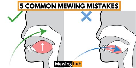 Avoid These Top 5 Mewing Mistakes for Better Results – Mewinghub