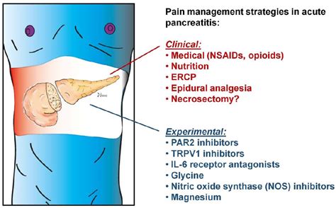 [PDF] Pain Management in Acute Pancreatitis | Semantic Scholar