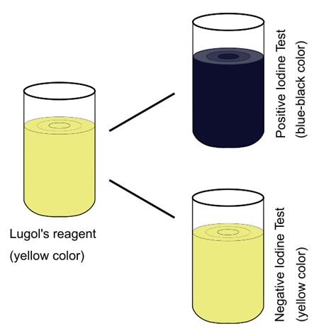 Iodine Test Iodine Test For Starch Principle, Procedure,, 47% OFF