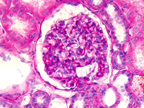 Gambar Mikroskopis Glomerulus Di Ginjal Manusia Foto Stok - Unduh Gambar Sekarang - Ginjal ...