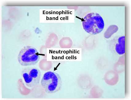 VETERINARY HEMATOLOGY DEXTERVET: band cells