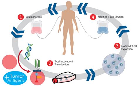 Natural Killer Cell Therapy - Immunotherapy Cancer Treatment