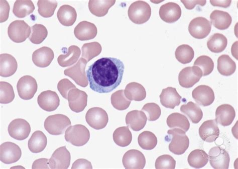 lymphocytes; nucleus round, ovoid, or slightly dimpled on one side, of uniform or mottled dark ...