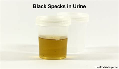 What Causes Black Specks In Urine?