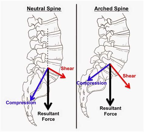 Safe Lifting and Material Handling Tips To Avoid Back Injury