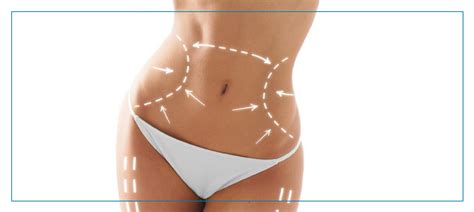 Liposuction Procedure Specialist Near Me in Fairfax, VA