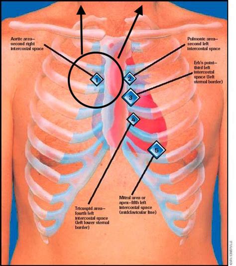 Guide To Heart Murmurs: Aortic Stenosis Murmur - Stepwards