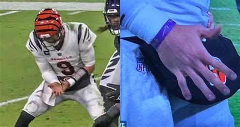 Close-Up Photo Shows How Swollen Joe Burrow's Injured Hand Is - Daily Snark