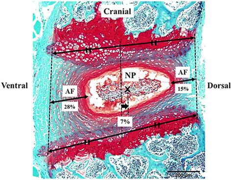 Annulus Fibrosus Histology