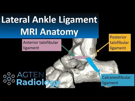 MRI Anatomy of lateral ankle ligaments - YouTube
