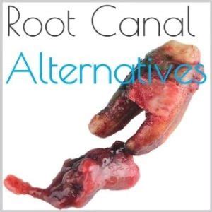 Root Canal Alternative