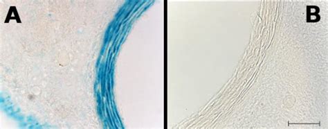 15. LacZ staining in the aortic wall of adult mice. LacZ staining was ...