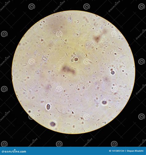 View in the Microscope on Trichomonas STD Stock Photo - Image of cervical, disease: 141385134