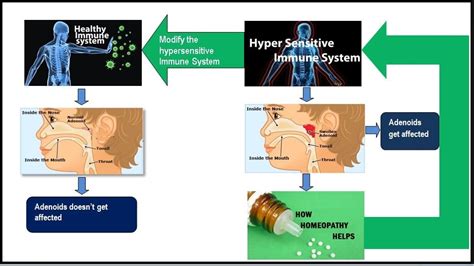 Natural Treatment for Adenoids - Philadelphia Holistic Clinic - Dr. Tsan