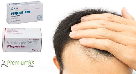 Finasteride 1mg for Hair Loss,- Propecia and Finpecia