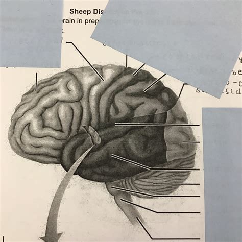 Brain Dissection SG: part 1 Diagram | Quizlet