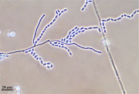 Geotrichum sp