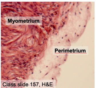 Perimetrium