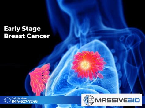 Early Stage Breast Cancer - Treatment of Breast Cancer - Massive Bio