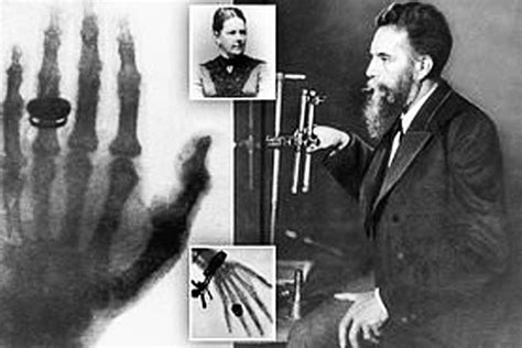 History of X-Ray Machine and Its Inventor Röntgen | Custom X-Ray