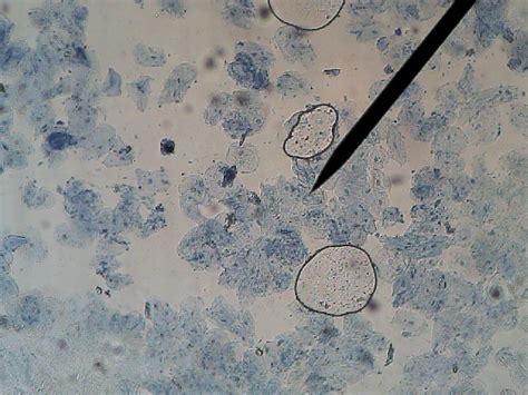 Cheek Cell Under Microscope