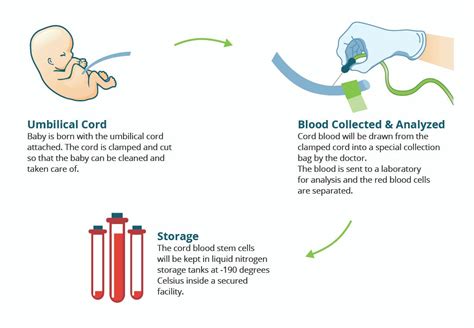 Umbilical Cord Blood Banking — A need for healthy society