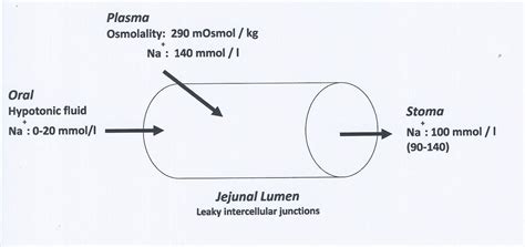 How to manage a high-output stoma | Frontline Gastroenterology