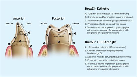 How to Prep and Cement BruxZir® Zirconia Crowns | New West