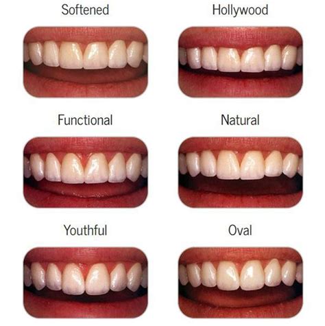 Cosmetic Dentistry - Los Angeles Cosmetic Dentistry - Culver City Cosmetic Dentistry - Centurysm ...