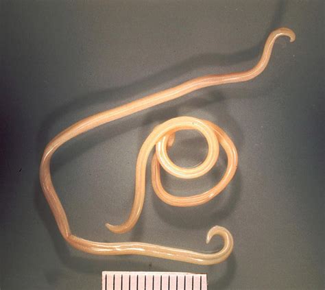 What Features Distinguish Annelids from Roundworms - Pediaa.Com