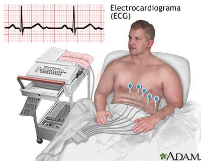 El Electrocardiograma | APUNTES AUXILIAR ENFERMERIA